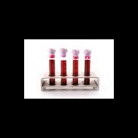 Метастазирование опухолей обнаружит специальная диагностическая система