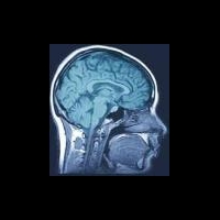 Амантадин поможет в реабилитации пациентов с черепно-мозговой травмой