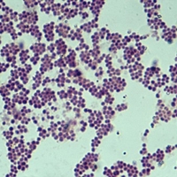 Смертельно опасный штамм менингококковой инфекции