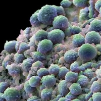 Исследован ген раковых клеток предстательной железы