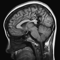 Наночастицы изменят МРТ-диагностику