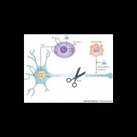 Новый класс анальгетиков при лечении хронической боли