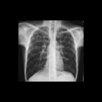 Перспективы в диагностике и лечении муковисцидоза