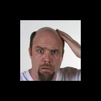 Выявлена причина облысения