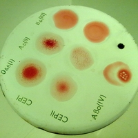 Обнаружен новый фактор риска сердечно-сосудистых заболеваний