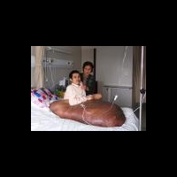 Достижение вьетнамских онкологов