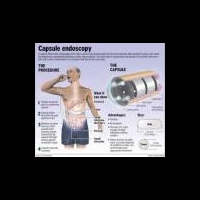 Таблетки-камеры нового поколения выявят болезни желудочно-кишечного тракта