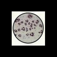 Novartis опубликовал результаты испытаний вакцины против менингококка В