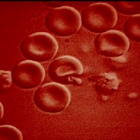 Вакцина, представляющая угрозу для жизни