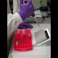 Генная терапия остеопороза: таблетка XXI века?