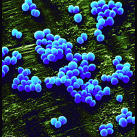 За госпитальную инфекцию больница заплатит 1,5 миллиона долларов США